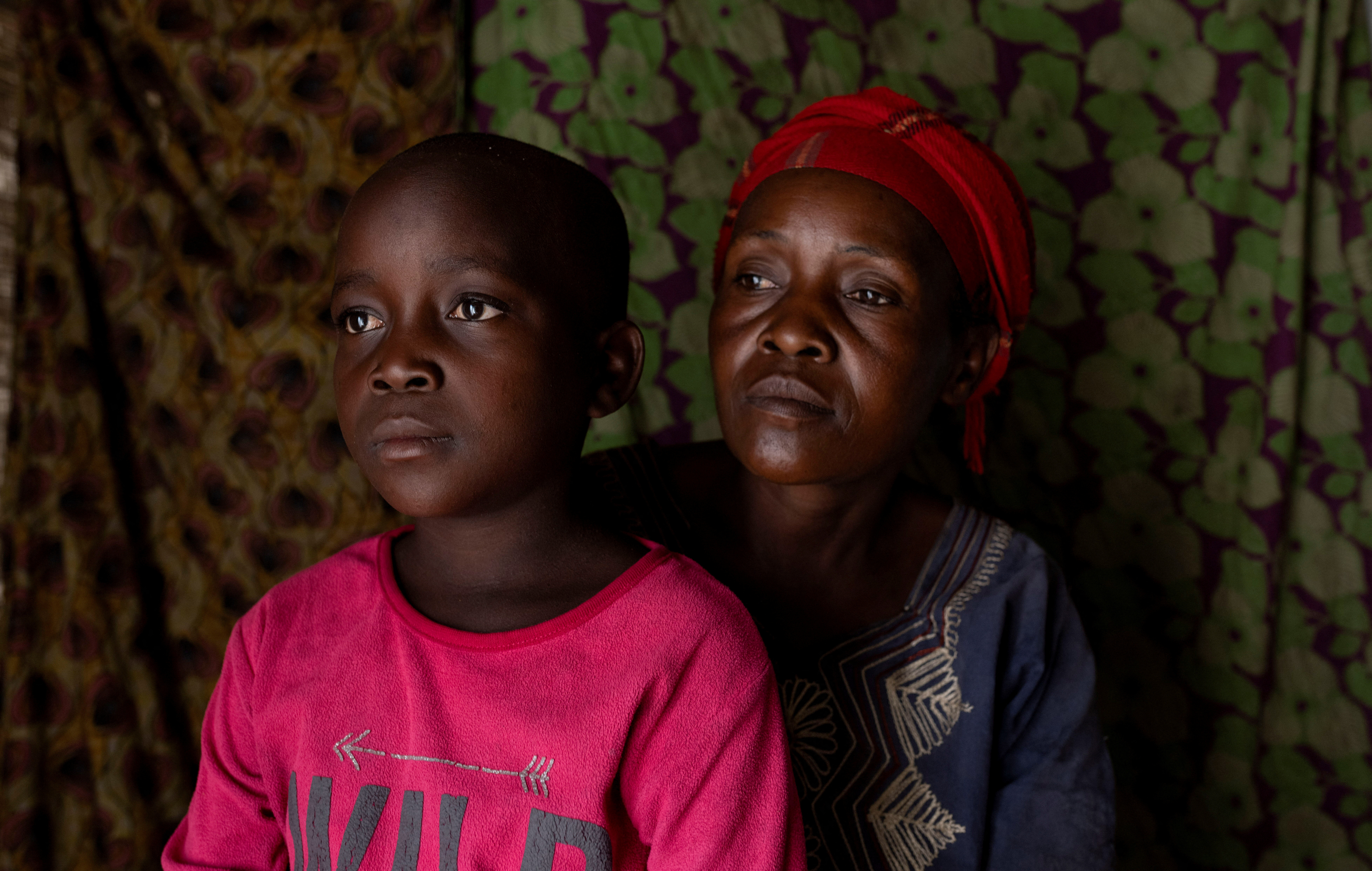 Children at risk as mpox variant hits Congo displacement camps