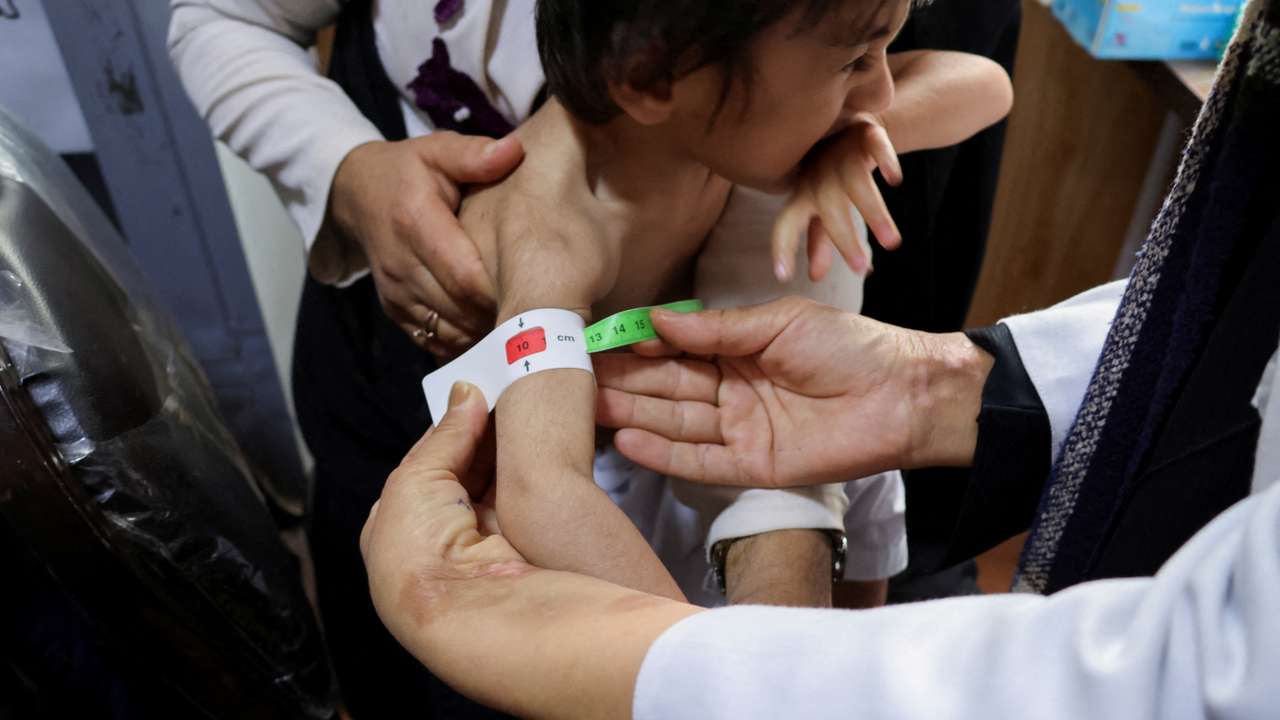 FILE PHOTO: NGOs fighting hunger in Afghanistan