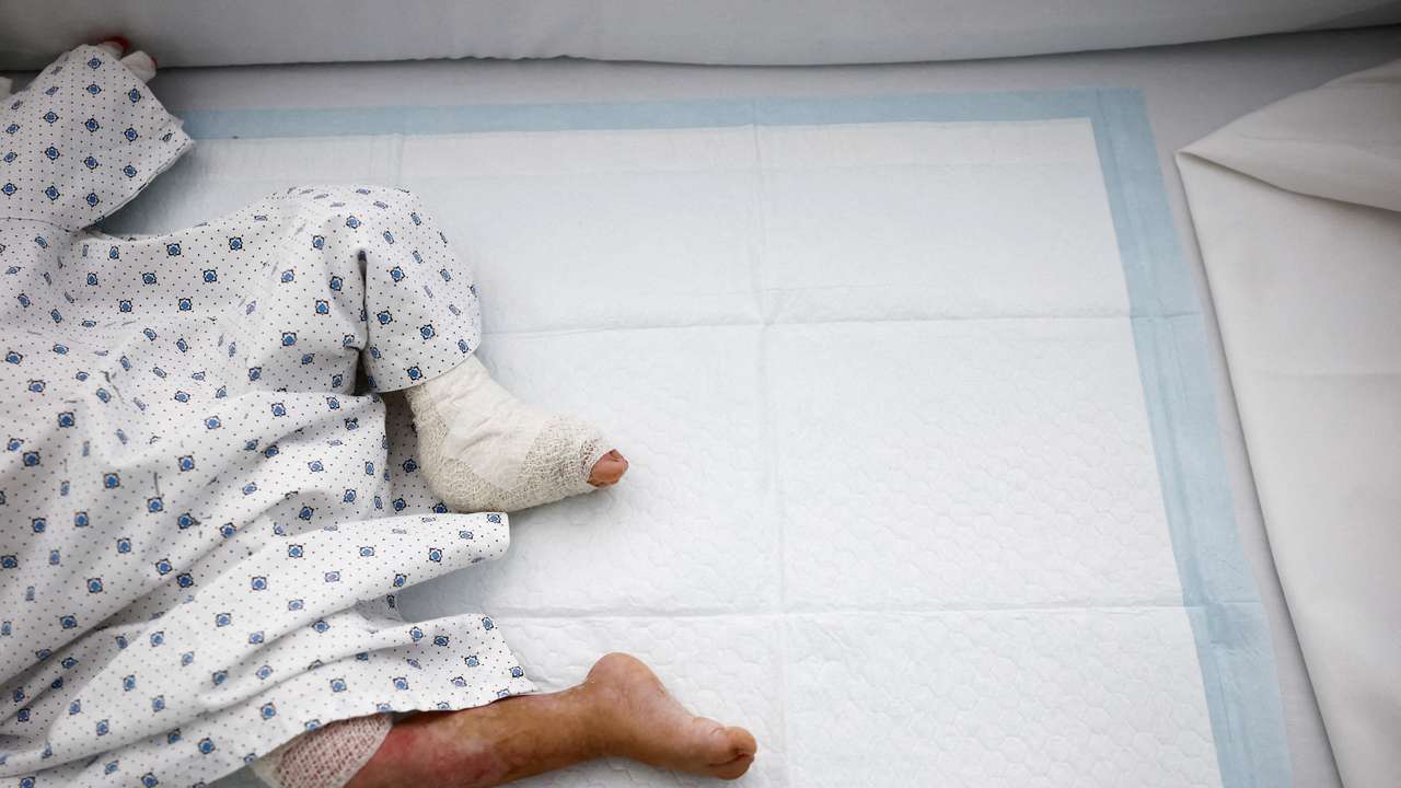 Lebanese toddler who was wounded in an Israeli strike receives treatment in Beirut Geitaoui Hospital
