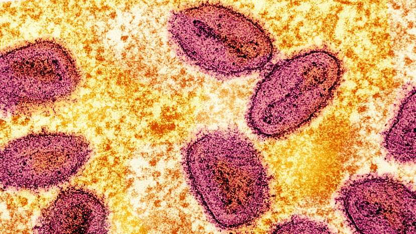 FILE PHOTO: Colorized transmission electron micrograph of mpox virus particles captured at the NIAID Integrated Research Facility in Fort Detrick