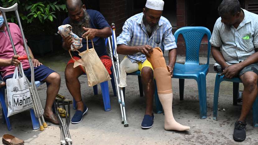 Artificial Limb Fitment Camp In Dhaka, Bangladesh