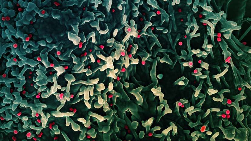 Colorized scanning electron micrograph of mpox virus captured at the NIAID Integrated Research Facility in Fort Detrick
