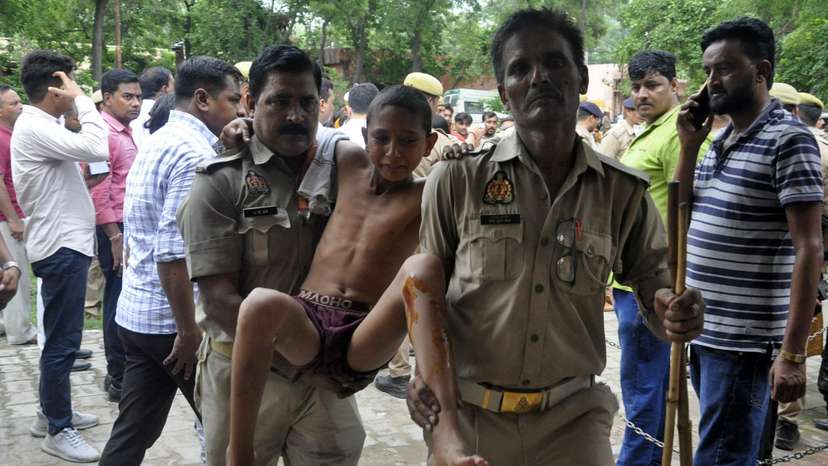 A boy, who was injured in a stampede at a religious gathering, reacts as he is brought to a hospital for treatment in Hathras district