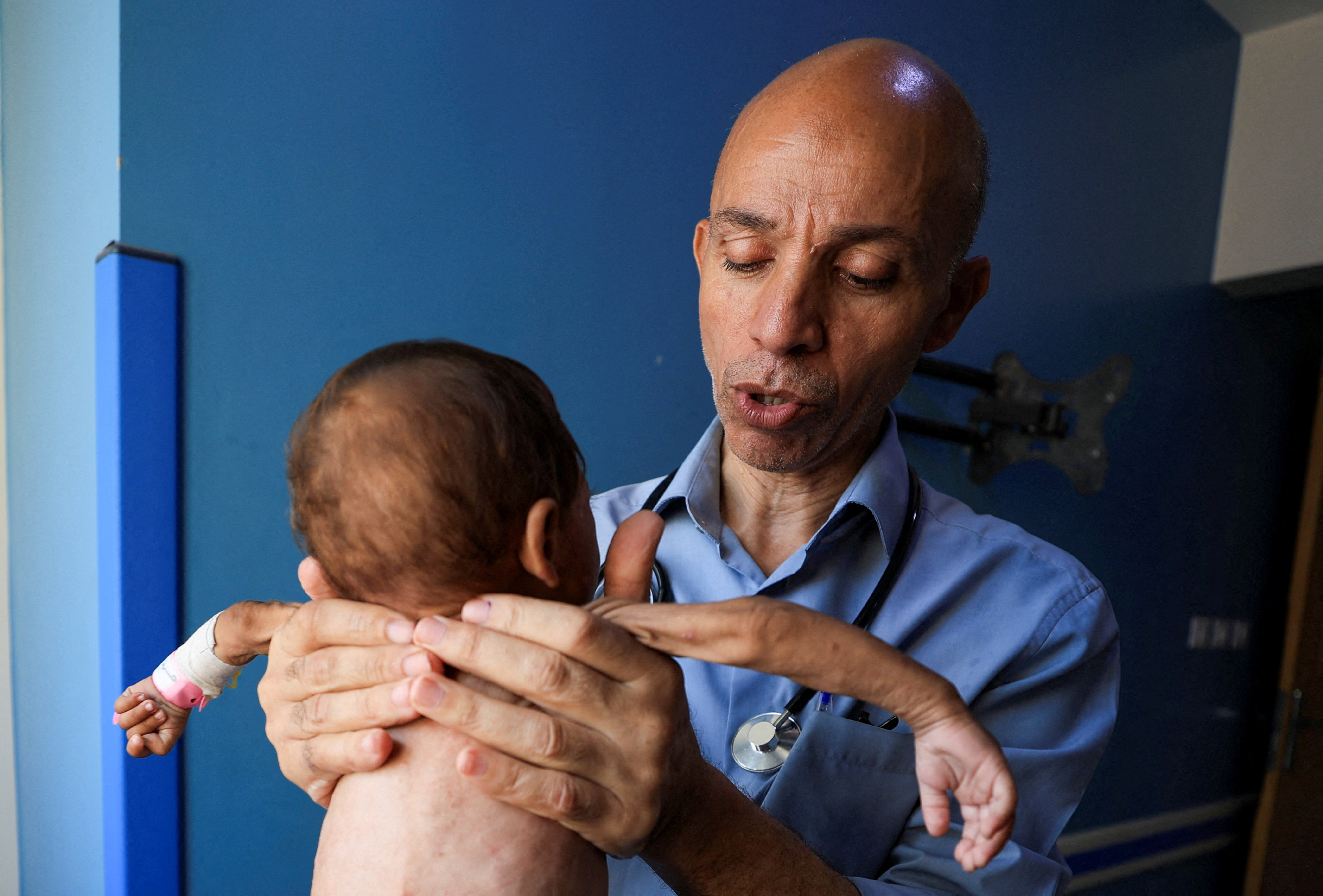 Palestinian doctor Ahmed Basal examines a child for malnutrition at Al-Rantisi Hospital in Gaza City