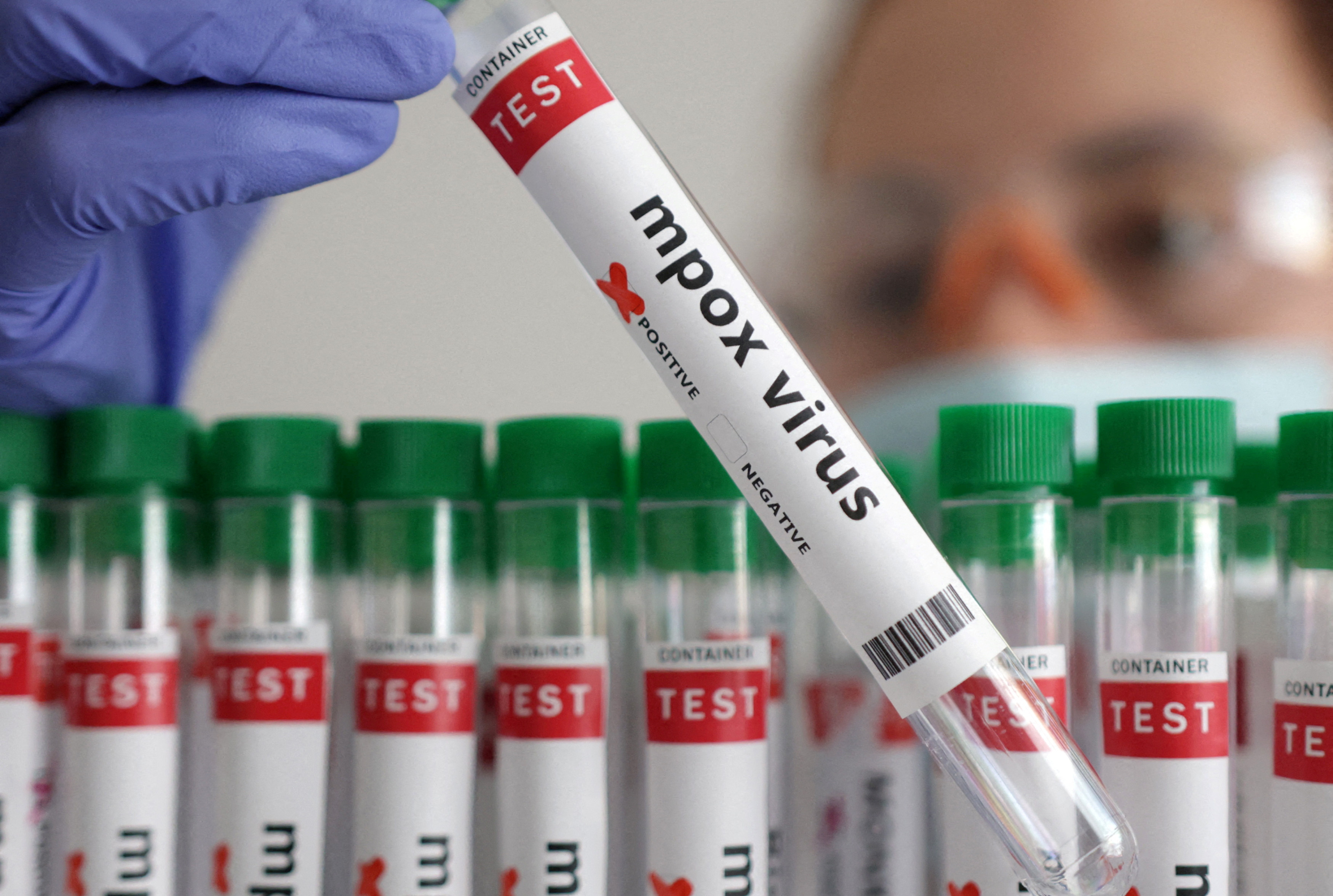 FILE PHOTO: Illustration shows test tubes with "Mpox virus positive" label