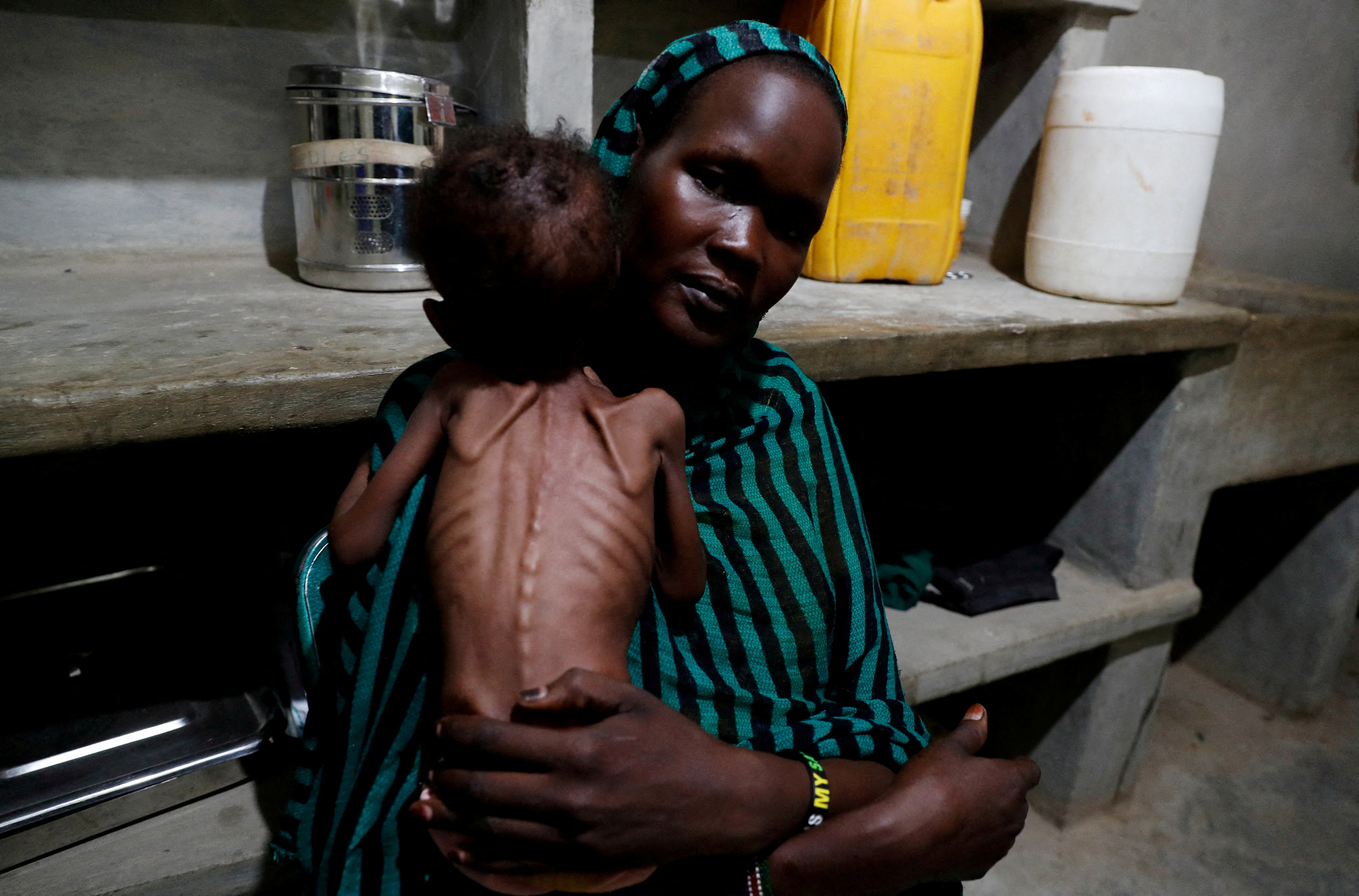 FILE PHOTO: A mother holds her severely malnourished child in South Kordofan, Sudan