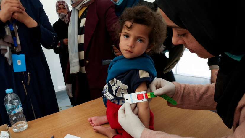 Palestinian children are checked for malnutrition, in Rafah, in the southern Gaza Strip