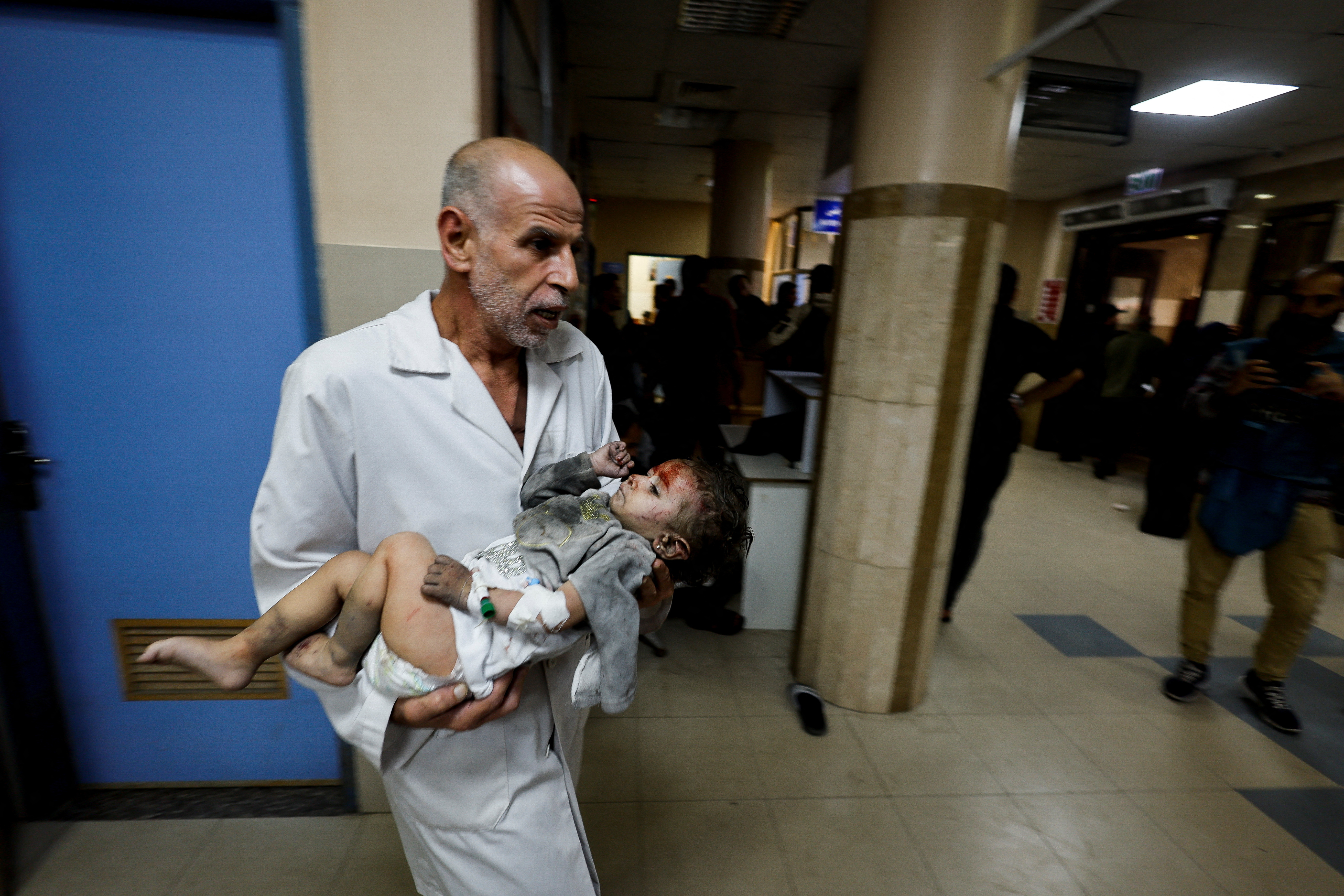 A Palestinian child wounded in an Israeli strike is assisted at Nasser hospital in Khan Younis