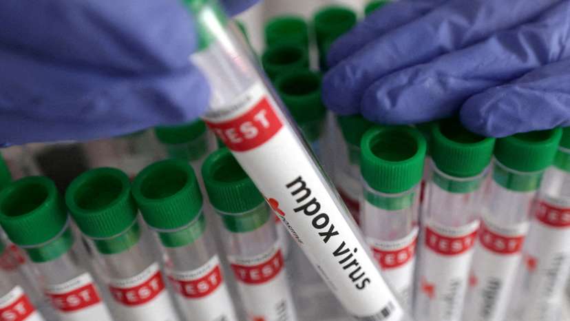 FILE PHOTO: Illustration shows test tubes with "Mpox virus positive" label