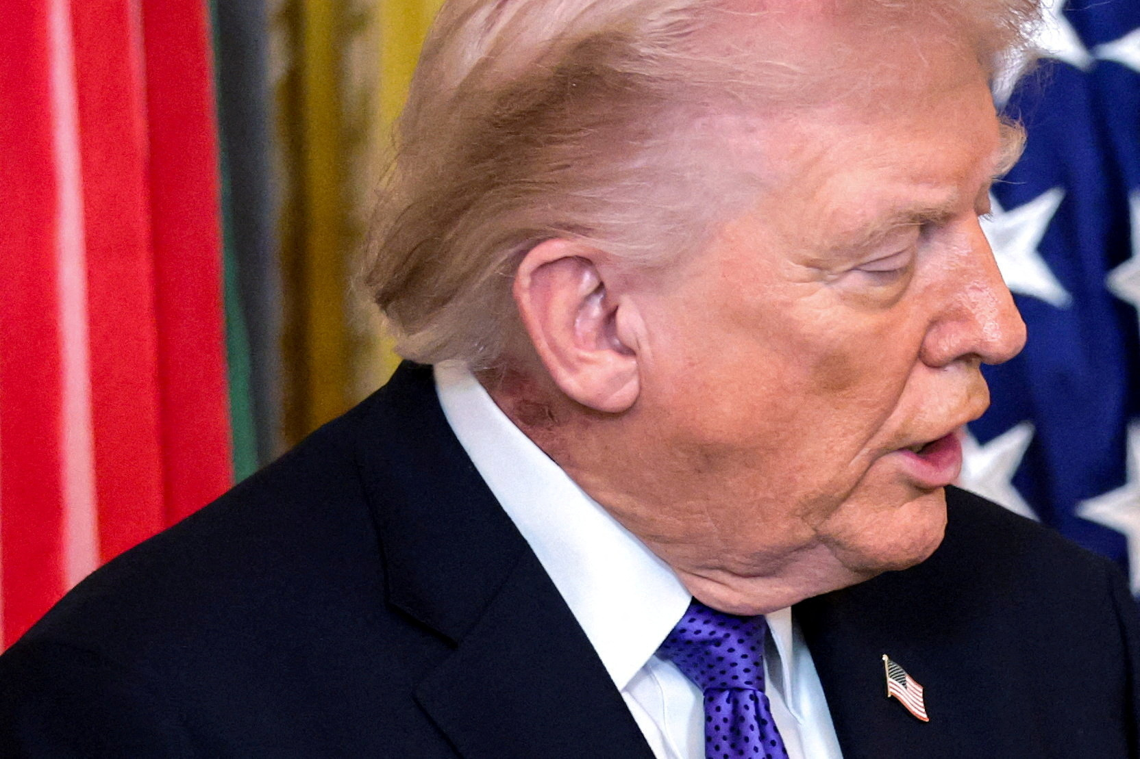 A patch of blemished skin is visible on U.S. President Trump’s neck at the White House in Washington