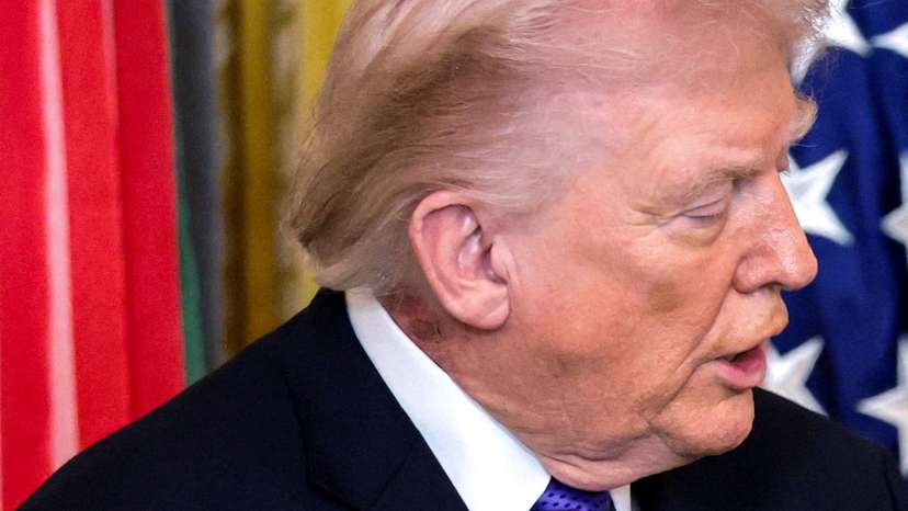 A patch of blemished skin is visible on U.S. President Trump’s neck at the White House in Washington