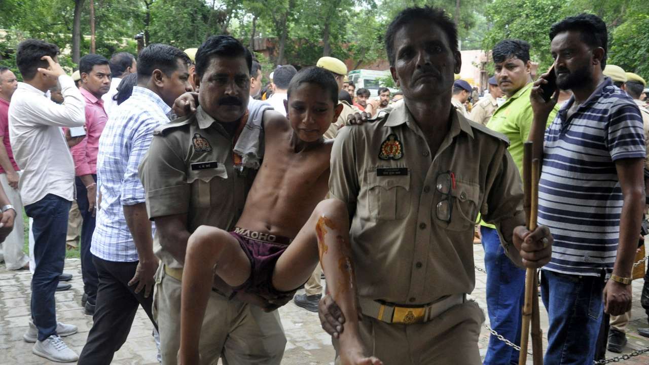 A boy, who was injured in a stampede at a religious gathering, reacts as he is brought to a hospital for treatment in Hathras district
