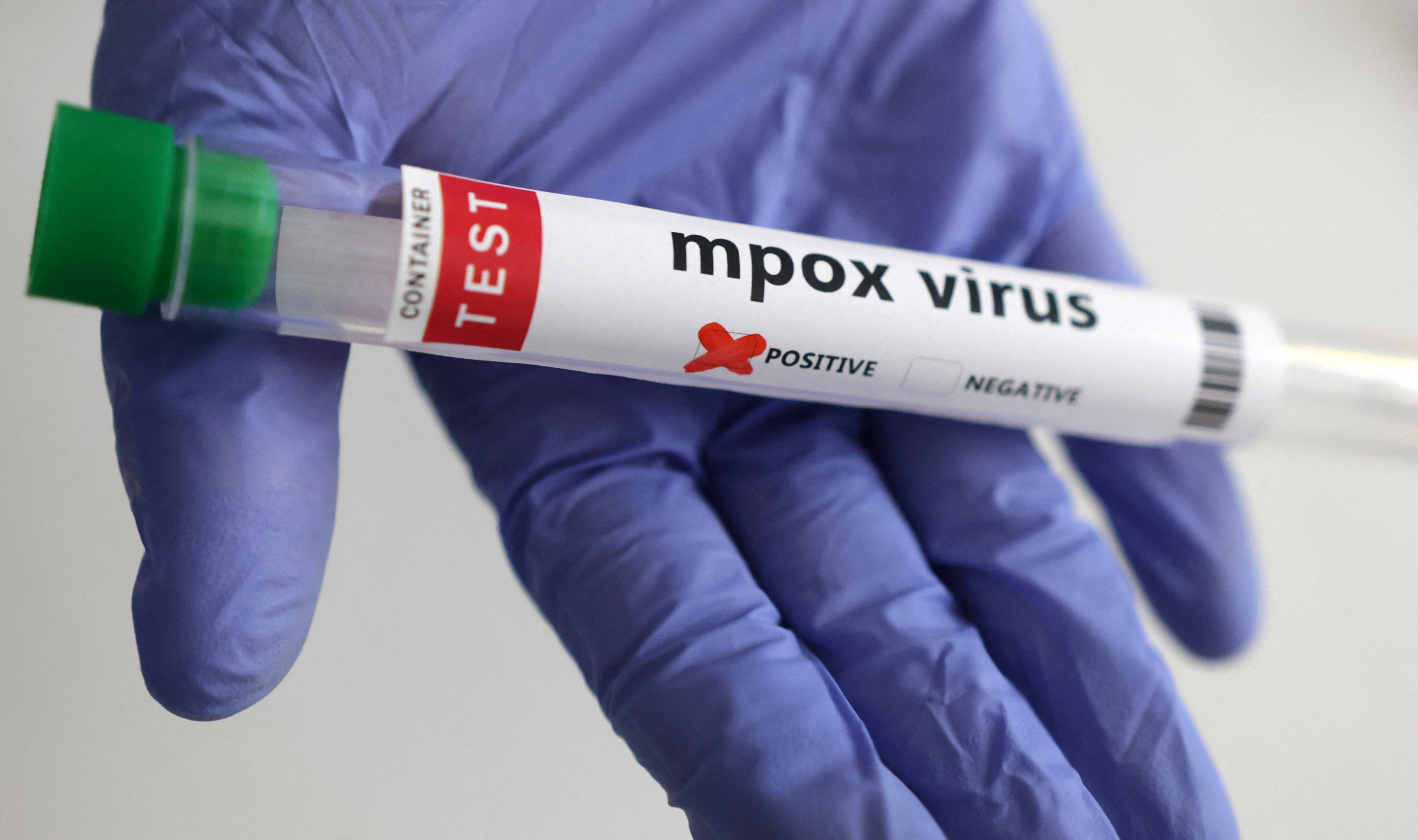 Illustration shows test tubes with "Mpox virus positive" label
