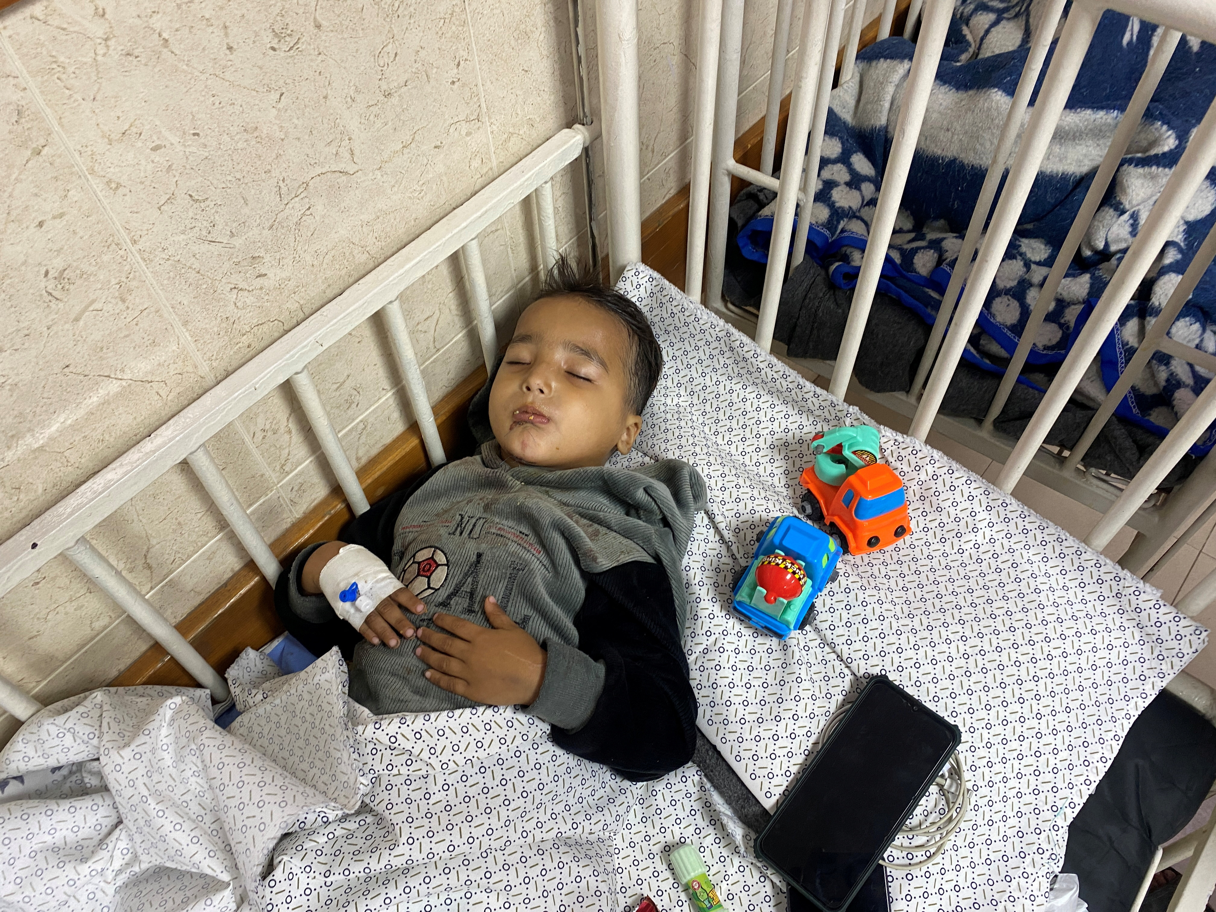 Bombarded twice, 4-year-old Gazan loses his parents, then his lower limbs