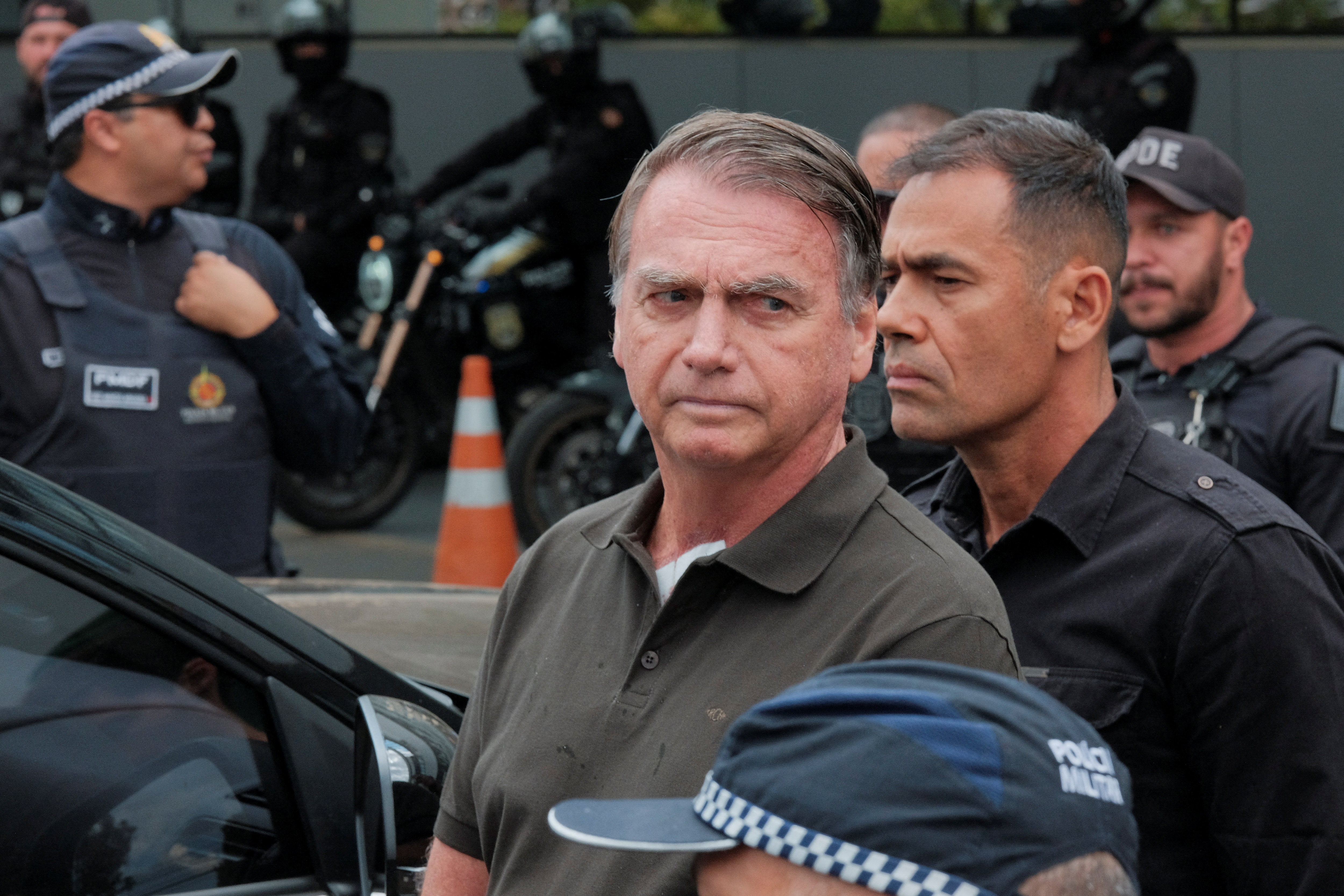 Former Brazilian President Bolsonaro to undergo skin surgery, in Brasilia