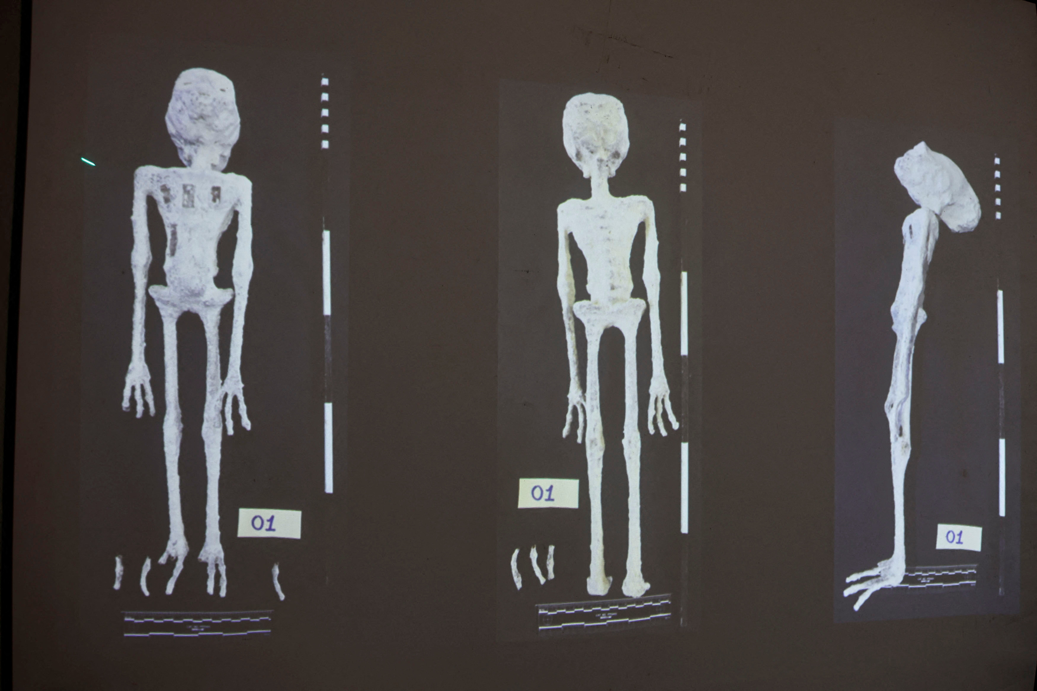 An X-rays and study carried out by the Institute of Legal Medicine of Peru on the 'alien mummies' that concluded that they are dolls made with animal bones is displayed in Lima