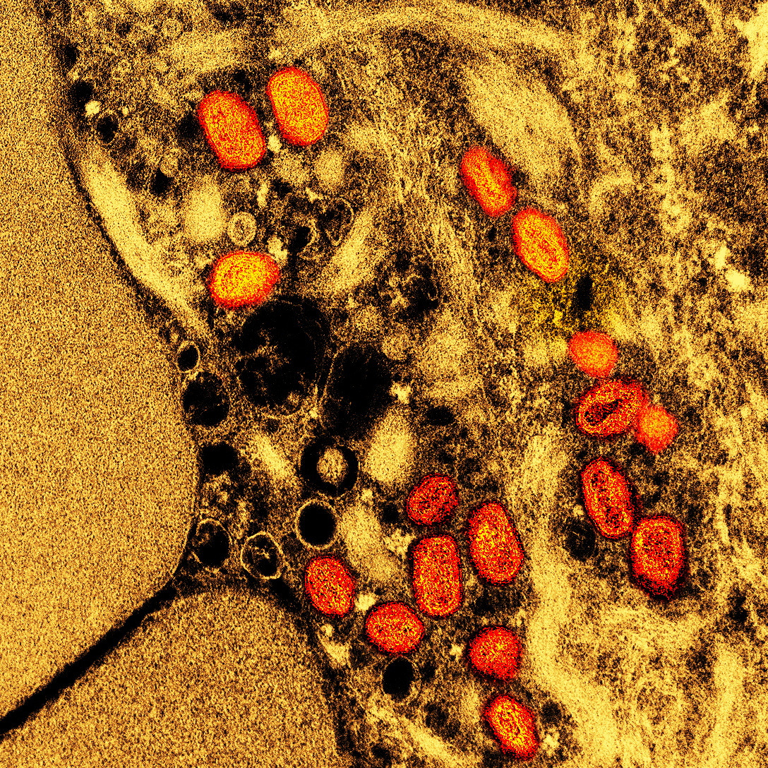 FILE PHOTO: Colorized transmission electron micrograph of mpox virus particles captured at the NIAID Integrated Research Facility in Fort Detrick