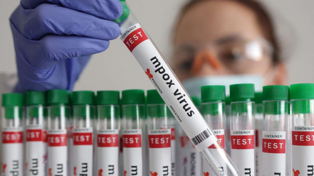 Illustration shows test tubes with "Mpox virus positive" label