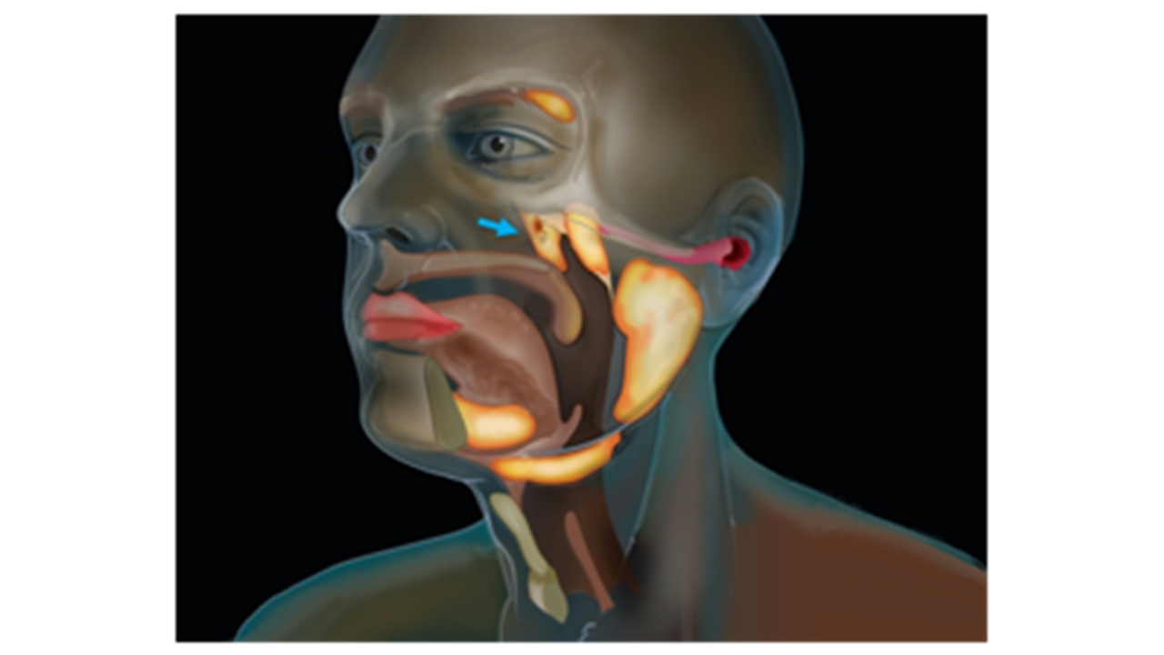cancer-researchers-discover-new-salivary-gland