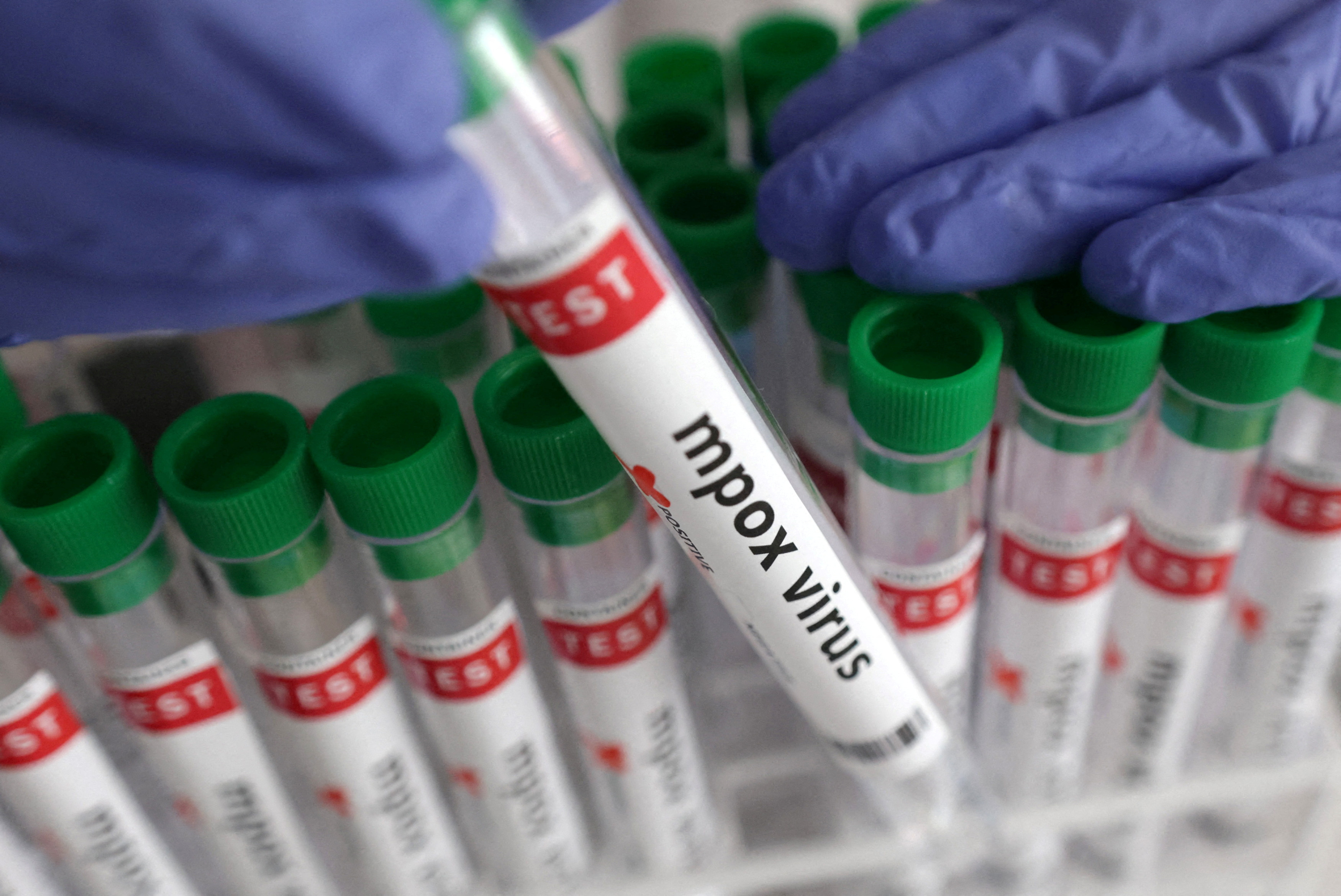 FILE PHOTO: Illustration shows test tubes with "Mpox virus positive" label