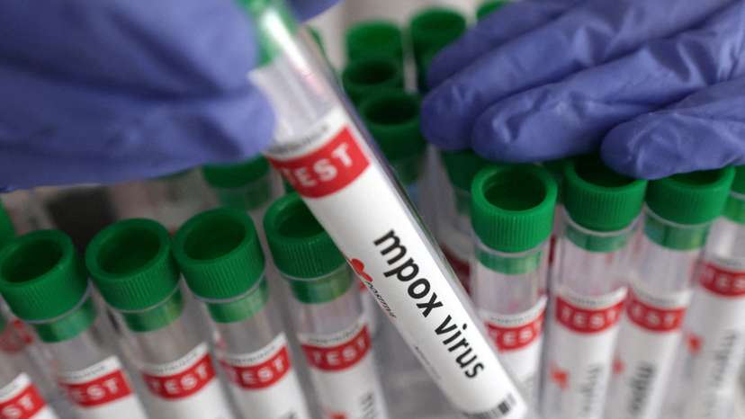 FILE PHOTO: Illustration shows test tubes with "Mpox virus positive" label