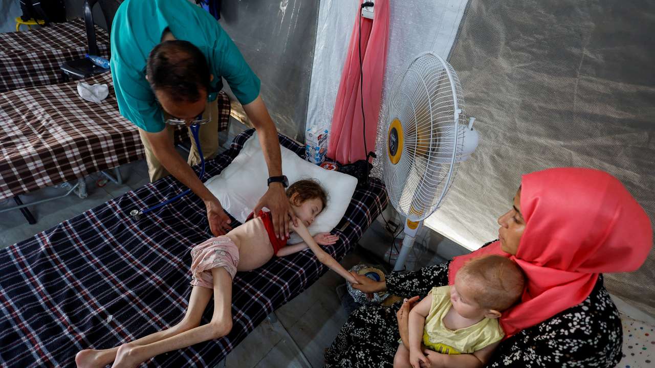 Malnourished Palestinian children receive treatment at the IMC field hospital in Deir Al-Balah, central Gaza Strip