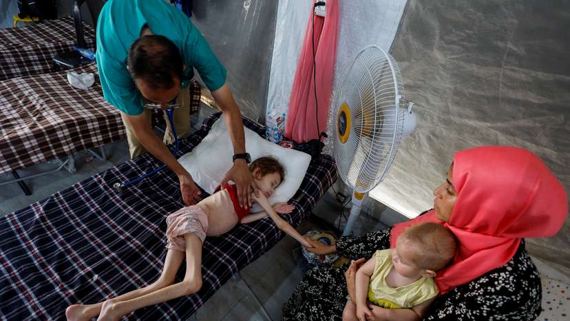 Malnourished Palestinian children receive treatment at the IMC field hospital in Deir Al-Balah, central Gaza Strip