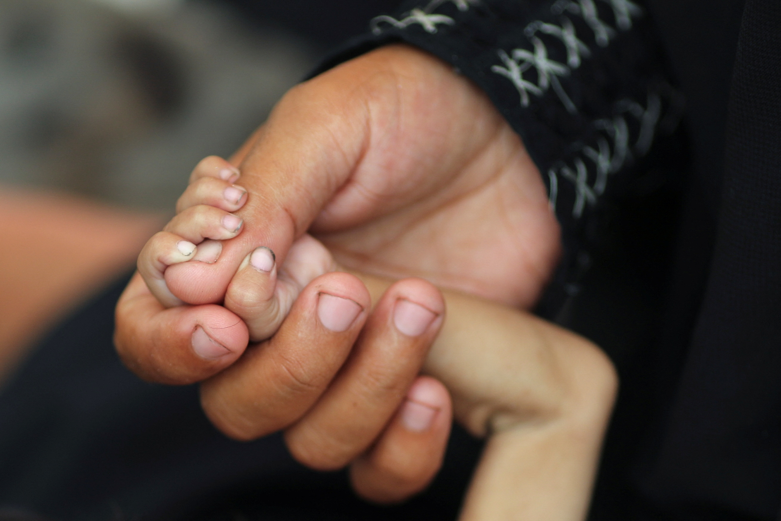 Palestinian mother Amira Muteir holds the hand of her five-month-old baby Ammar, whom she says is wasting away from malnutrition, in Gaza City