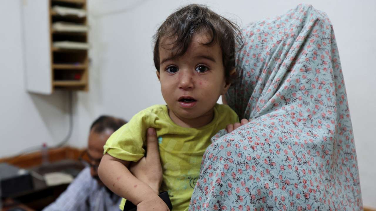 Fears over the spread of polio after the first case was reported by the ministry of heath, as the conflict between Israel and Hamas continues, in Gaza