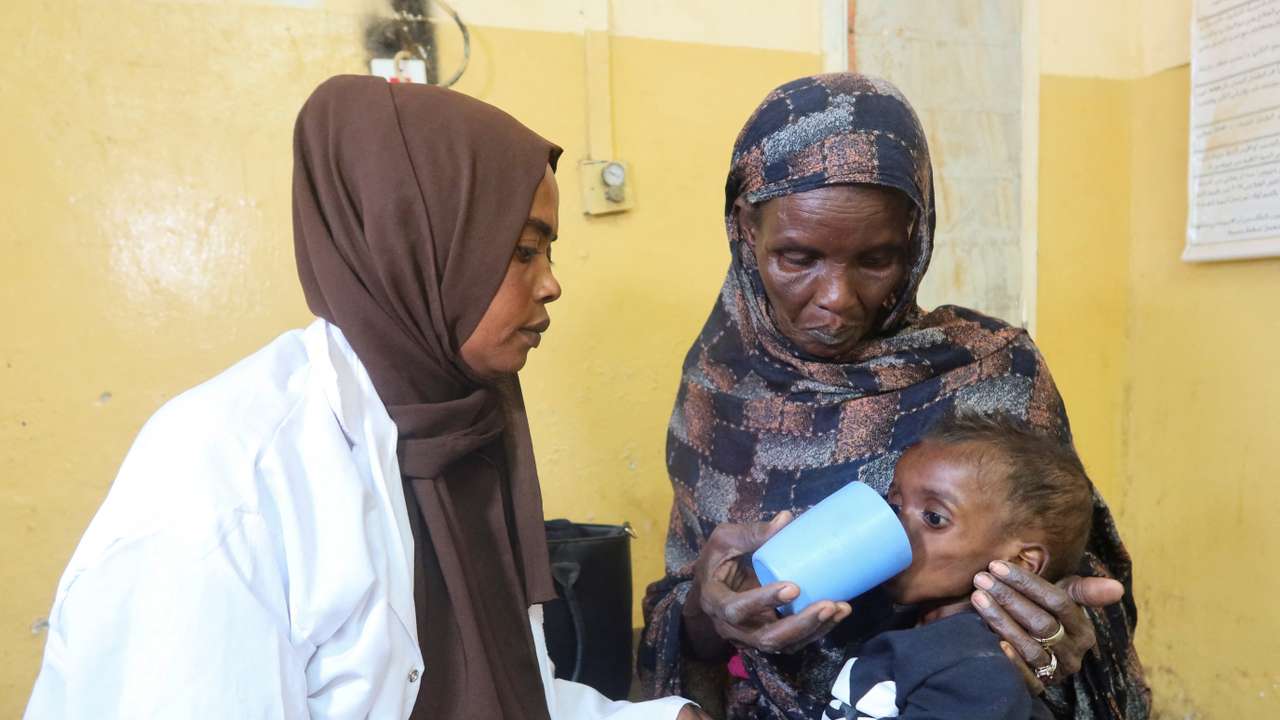 Children struggling with malnutrition fill wards in the Sharg Elnil area