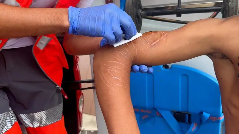 Migrants Face Hunger, Violence Inside Ceuta Camps