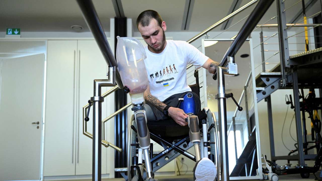 FILE PHOTO: German artificial limb maker shows Ukrainians how to use its products on war victims