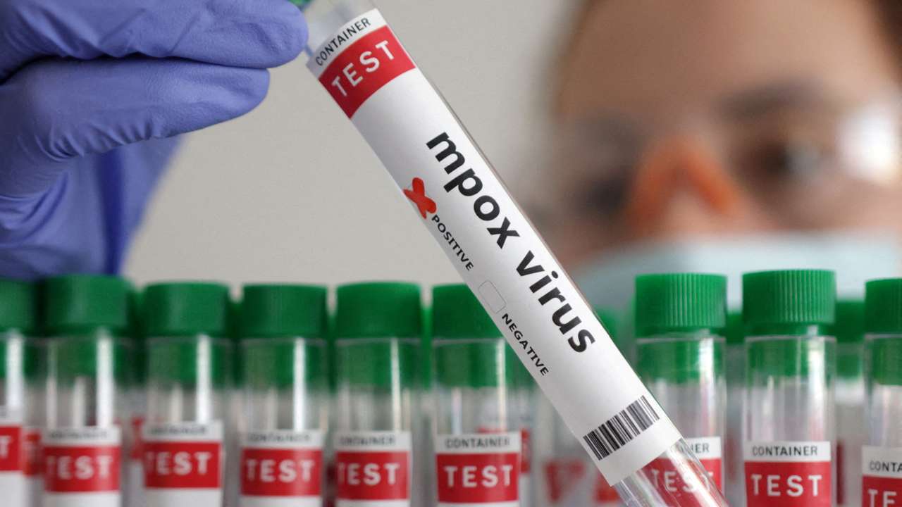 FILE PHOTO: Illustration shows test tubes with "Mpox virus positive" label
