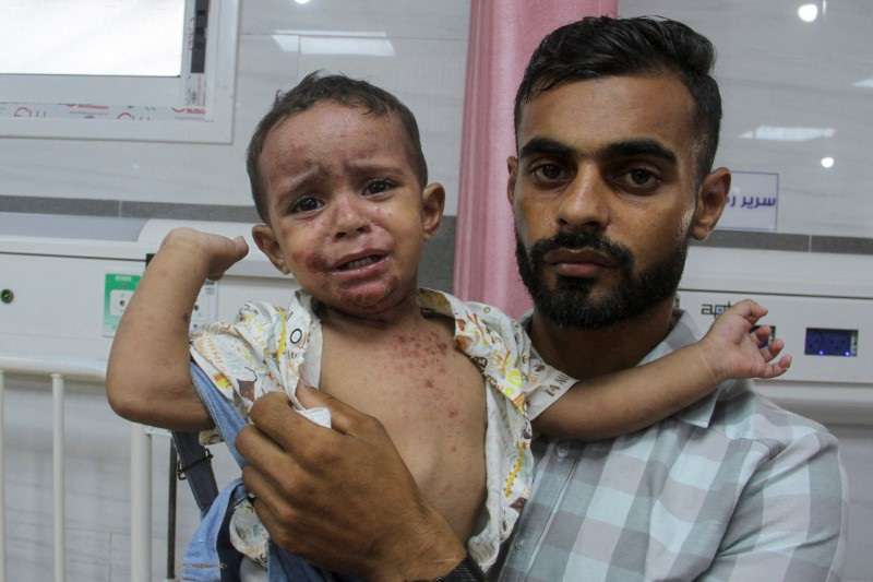 Skin diseases worsen the plight of Gazans as war drags on