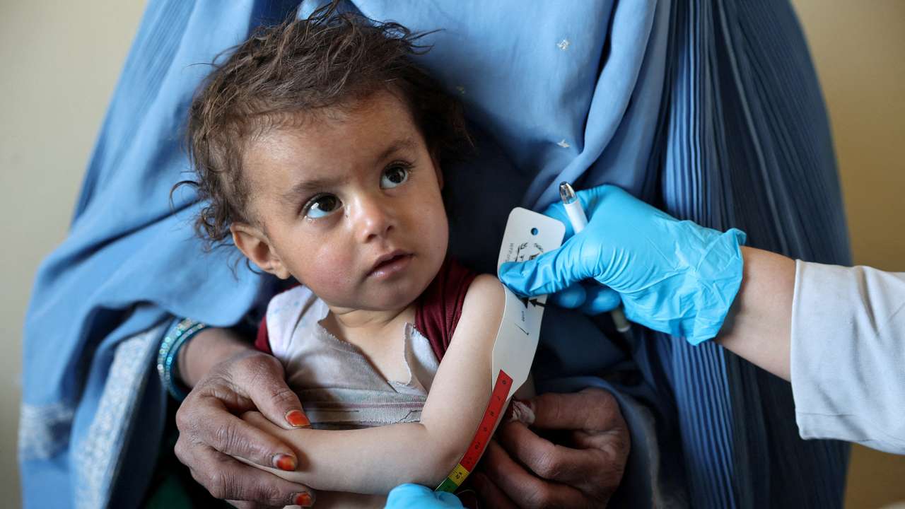 An Afghan girl looks the doctor as he measure her upper arm at the WFP-supported Qasaba Clinic, in Kabul