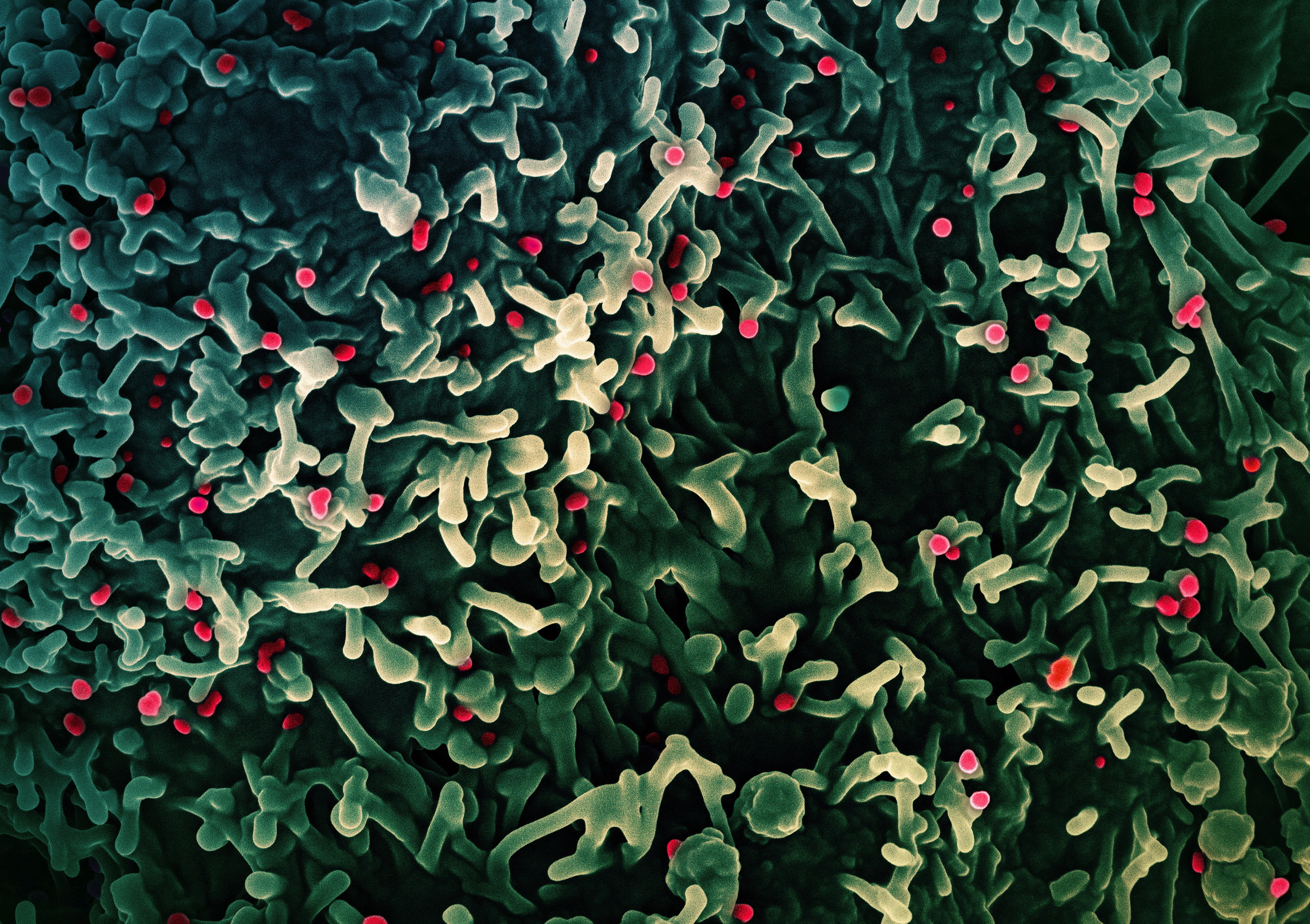 FILE PHOTO: Colorized scanning electron micrograph of mpox virus captured at the NIAID Integrated Research Facility in Fort Detrick