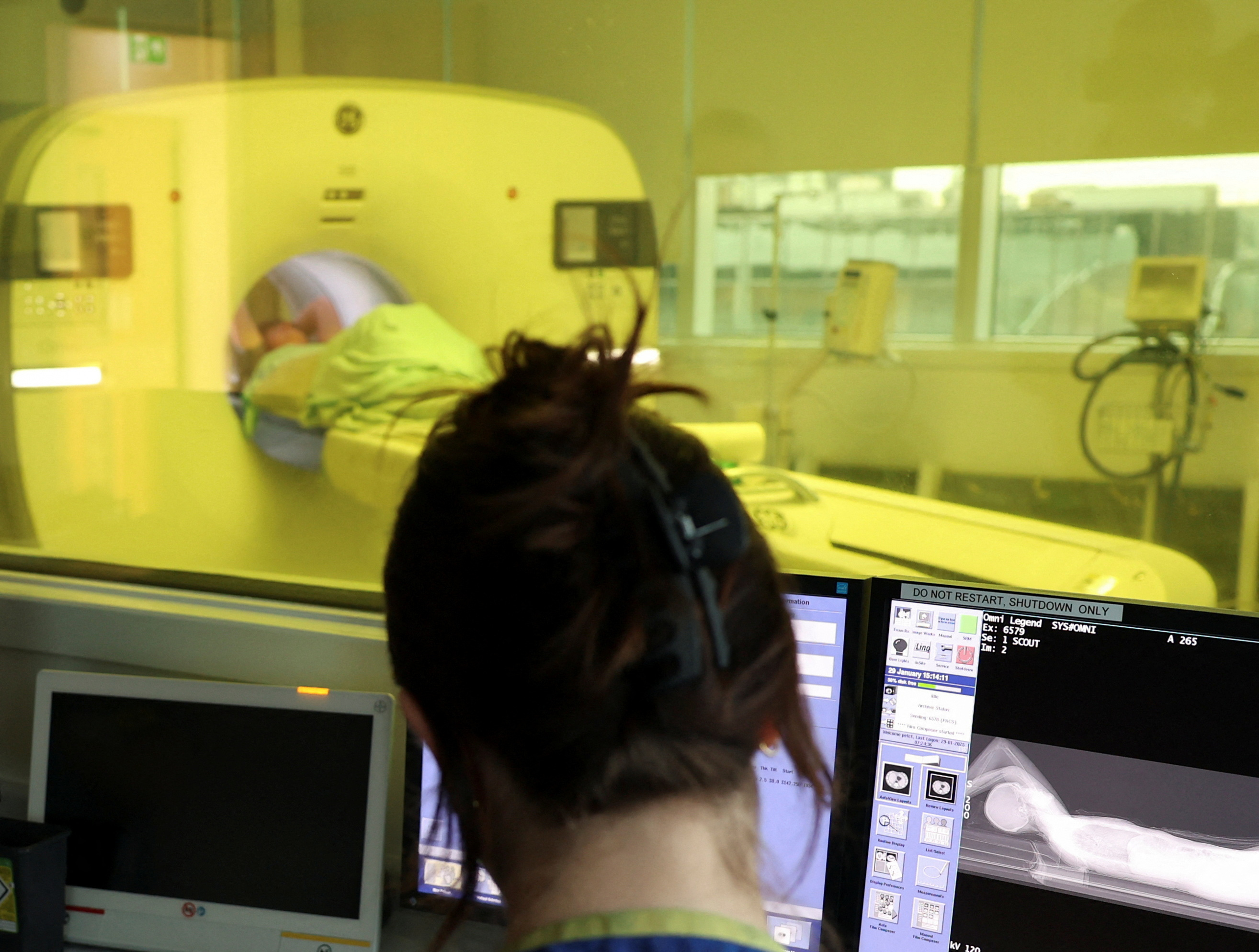 Molecular radiotherapy treatment at the University College London Hospitals (UCLH)