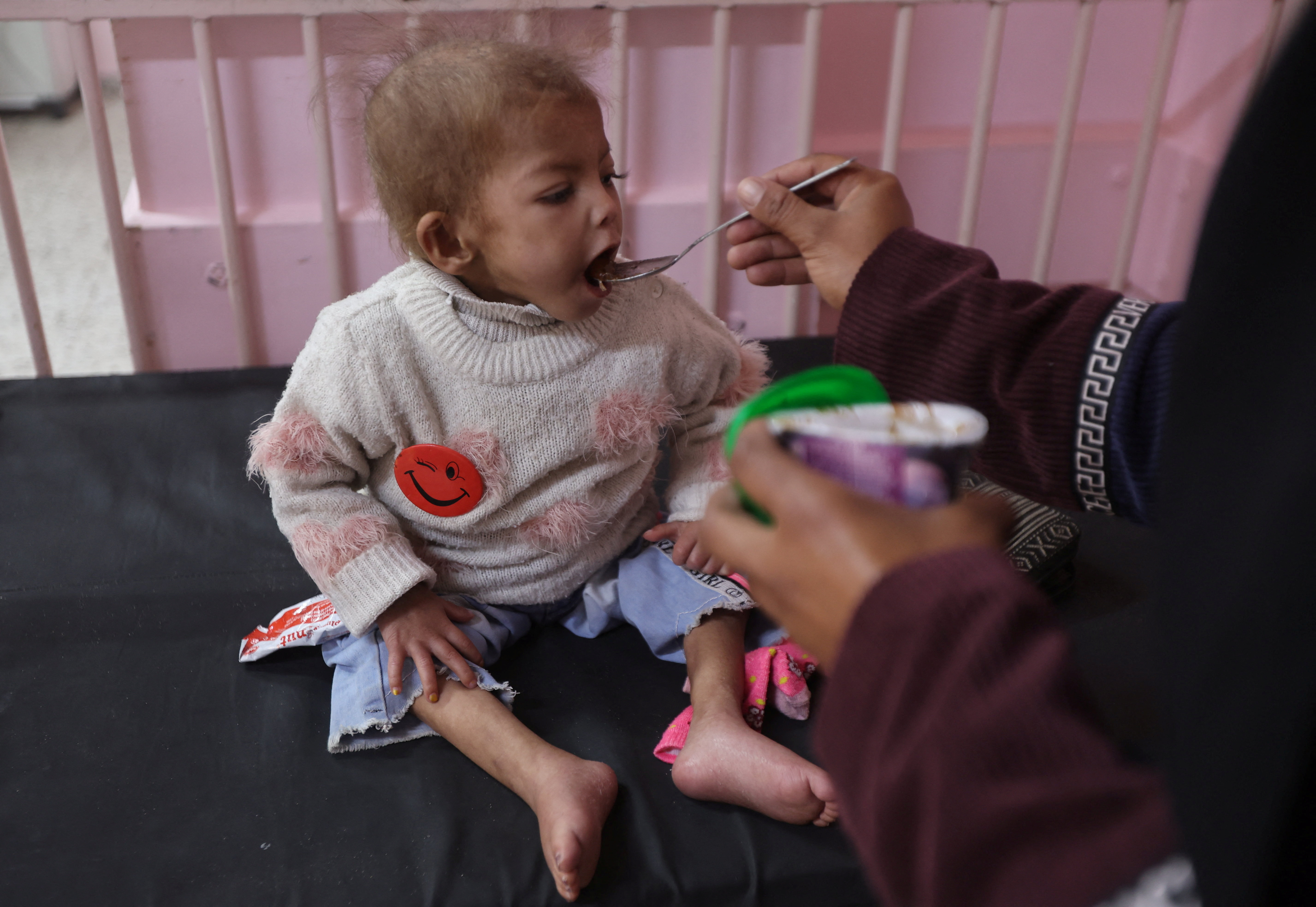 Arjwan Al-Dahini, a Palestinian child, who doctors say suffers from severe acute malnutrition, sits on a hospital bed while being fed by her mother, at Nasser Hospital in Khan Younis