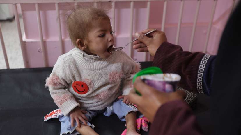 Arjwan Al-Dahini, a Palestinian child, who doctors say suffers from severe acute malnutrition, sits on a hospital bed while being fed by her mother, at Nasser Hospital in Khan Younis