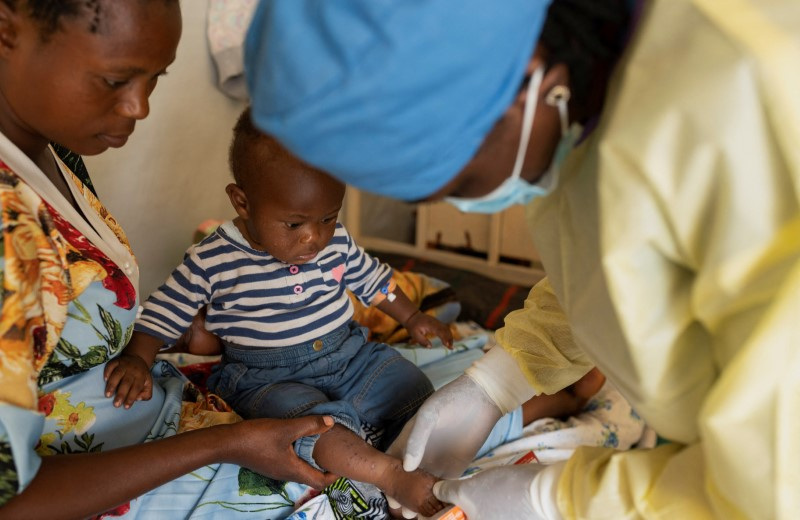 Children at risk as mpox variant hits Congo displacement camps