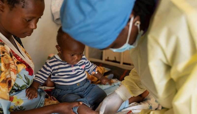 Children at risk as mpox variant hits Congo displacement camps