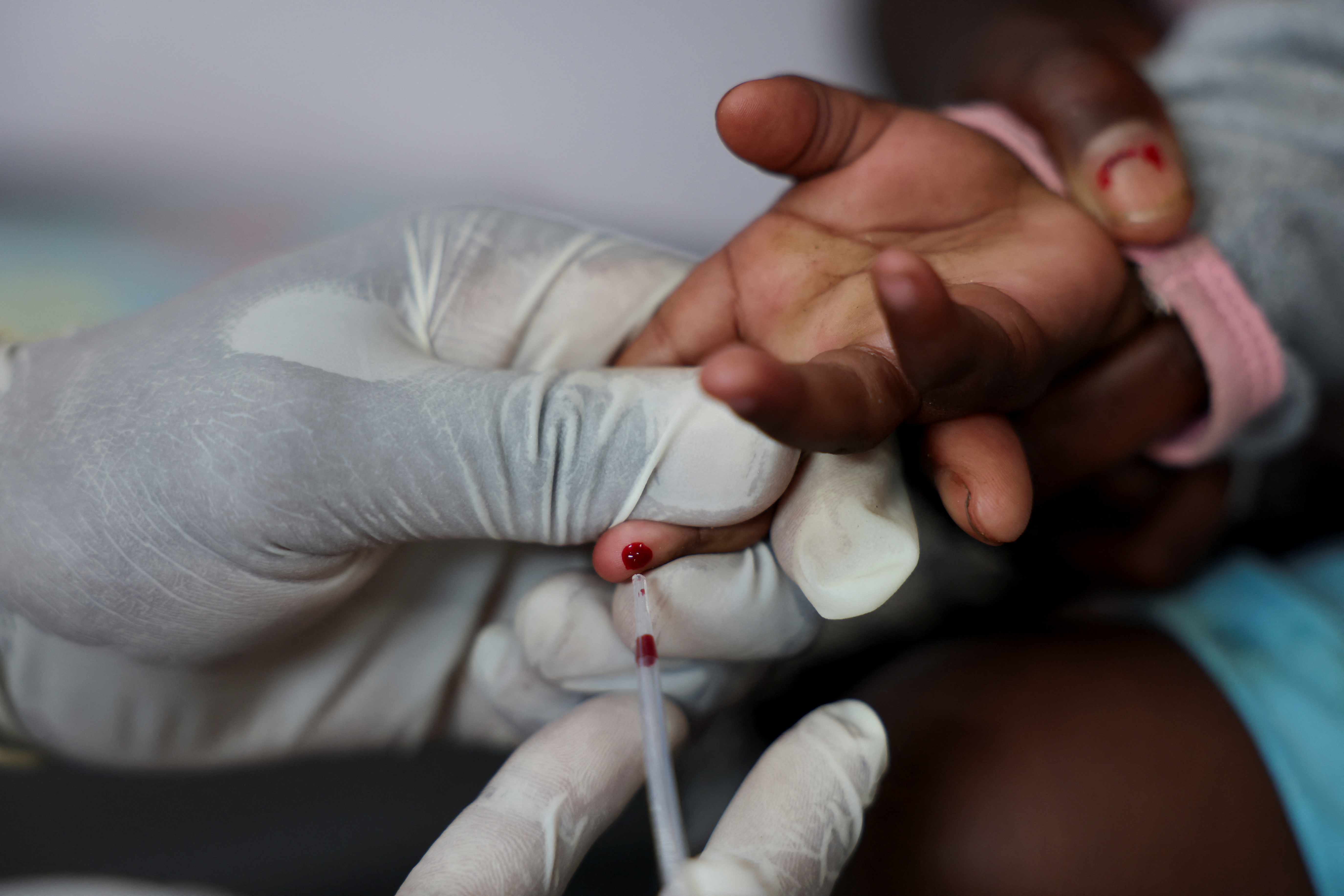 A nurse draws a blood sample from a child for an HIV test at a clinic in Diepsloot