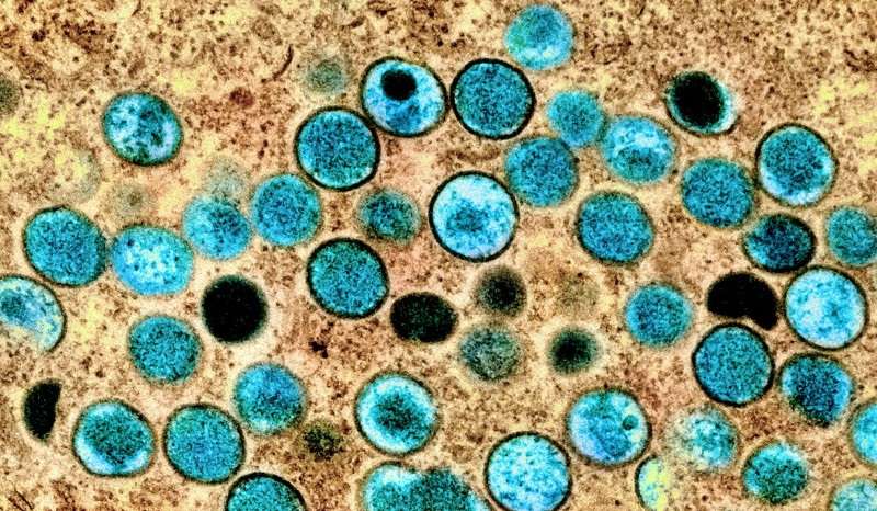 Colorized transmission electron micrograph of mpox virus particles captured at the NIAID Integrated Research Facility in Fort Detrick