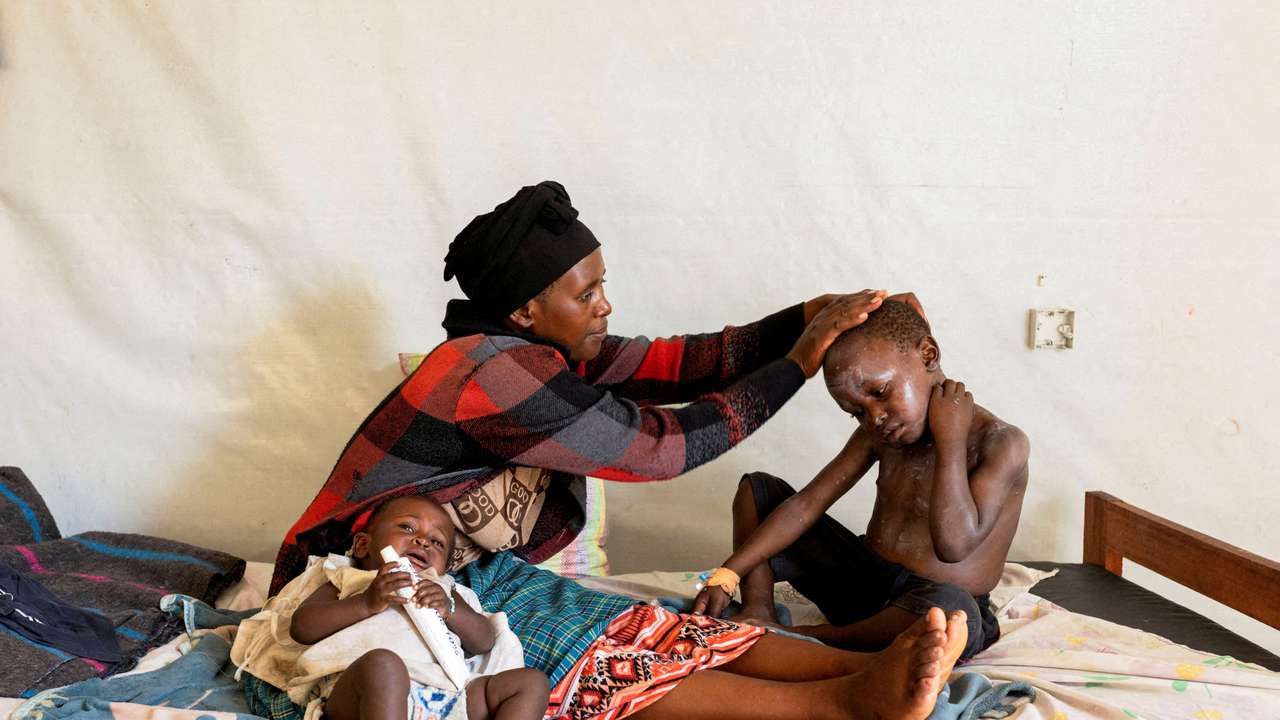 FILE PHOTO: Why mpox vaccines are only just arriving in Africa
