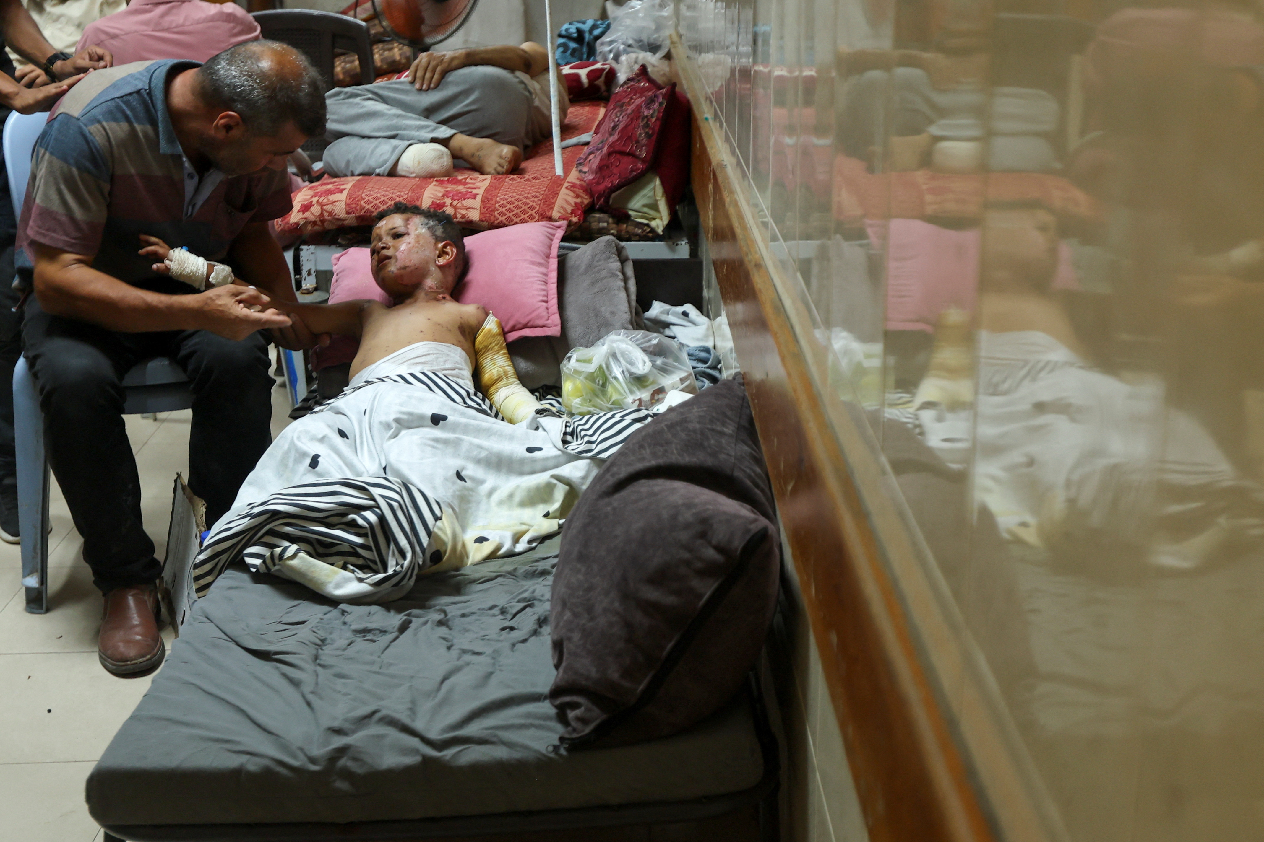 Palestinian boy suffers from burns caused by Israeli strike
