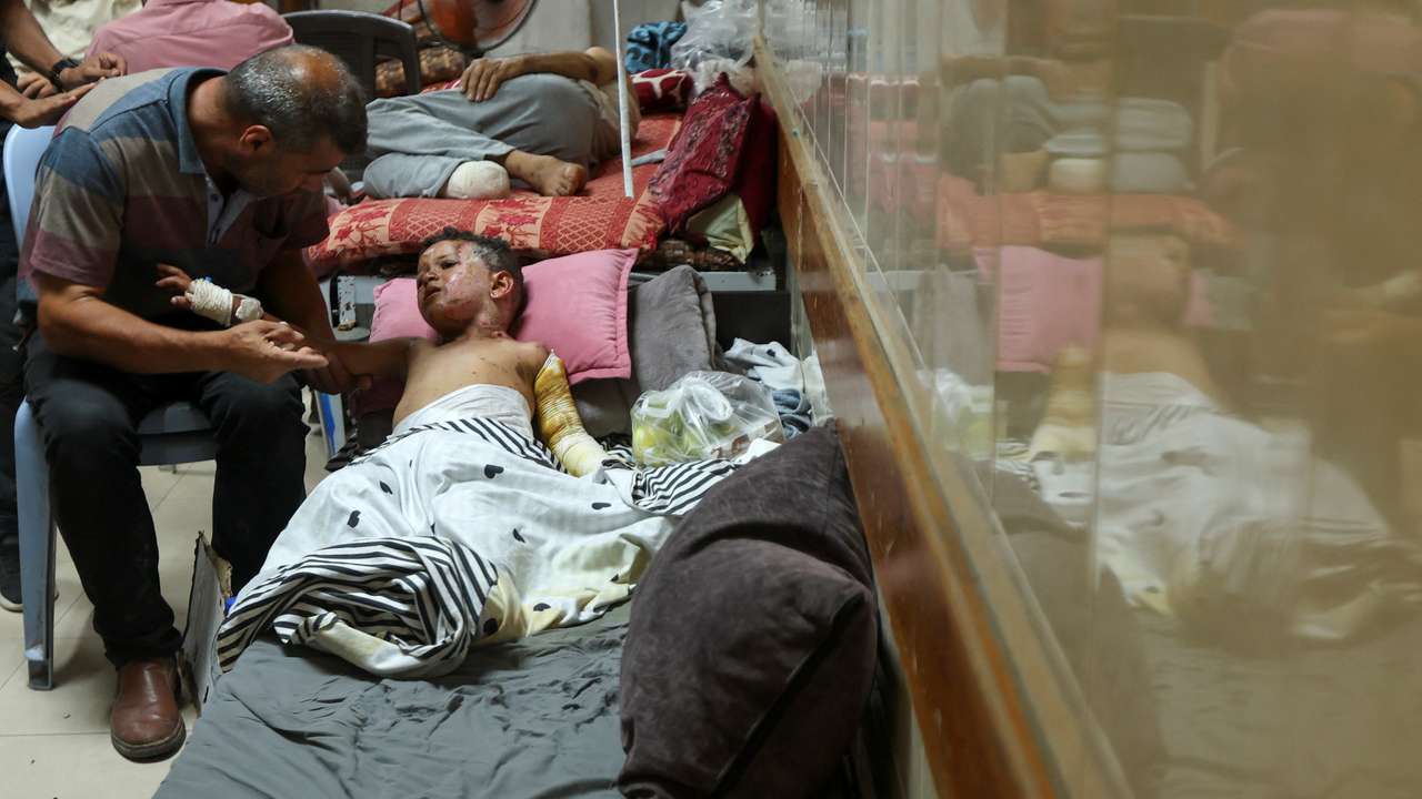 Palestinian boy suffers from burns caused by Israeli strike