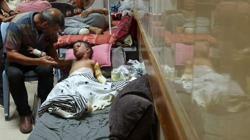 Palestinian boy suffers from burns caused by Israeli strike