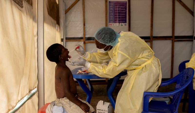 FILE PHOTO: Children at risk as mpox variant hits Congo displacement camps