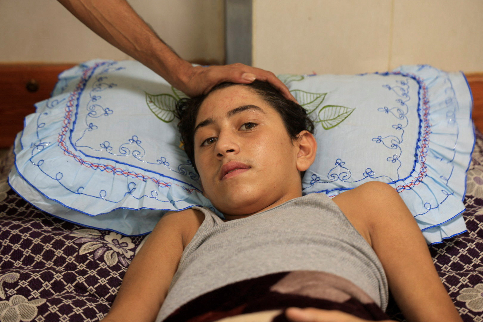 An Injured Palestinian boy Mohammed Helles, who suffered from a spinal cord injury during Israeli strikes,lies on a bed at Nasser Hospital, in Khan Younis