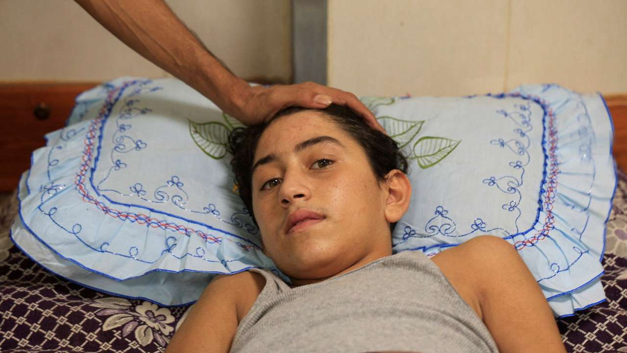 An Injured Palestinian boy Mohammed Helles, who suffered from a spinal cord injury during Israeli strikes,lies on a bed at Nasser Hospital, in Khan Younis